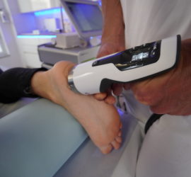 Stoßwellenbehandlung am Fuß